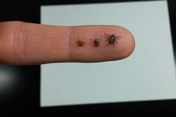 An array of ticks on a finger. 