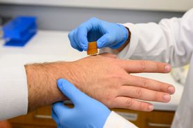 A WVU forensics researcher collects gunshot residue from a hand, using a sampling procedure in which carbon adhesive is mounted on an aluminum pin and plastic holder. Invisible gunshot residue can stick on the adhesive for further analysis. 